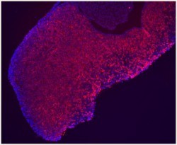 Somatotrophe cells